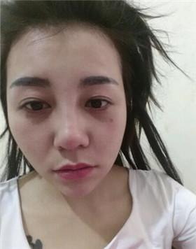 特朗普宣布纽约州为疫情重大灾区 将提供额外援助资金：xingkong.com(图2)